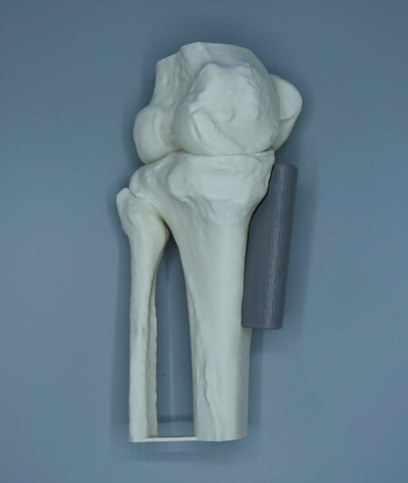 Practice Medication | Proximal Tibia