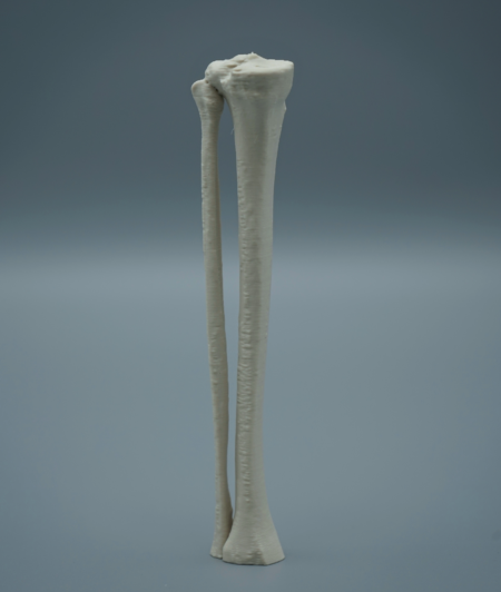 Practice Bone Model – Proximal Tibia Pediatric